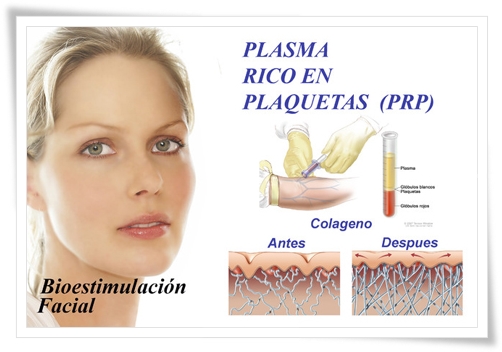 Plasma rico en plaquetas